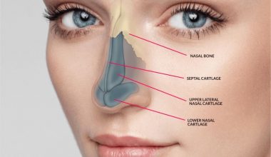 Nose Surgery cost