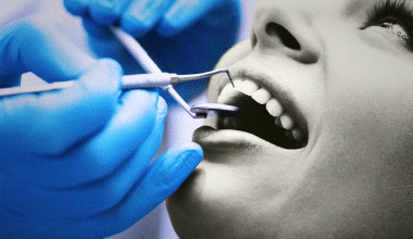 كم يكسب طبيب الأسنان في السنة